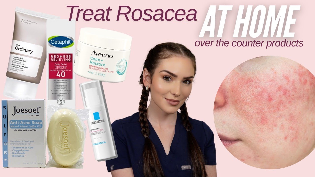 Over the Counter Rosacea Treatments | Treat at Home!