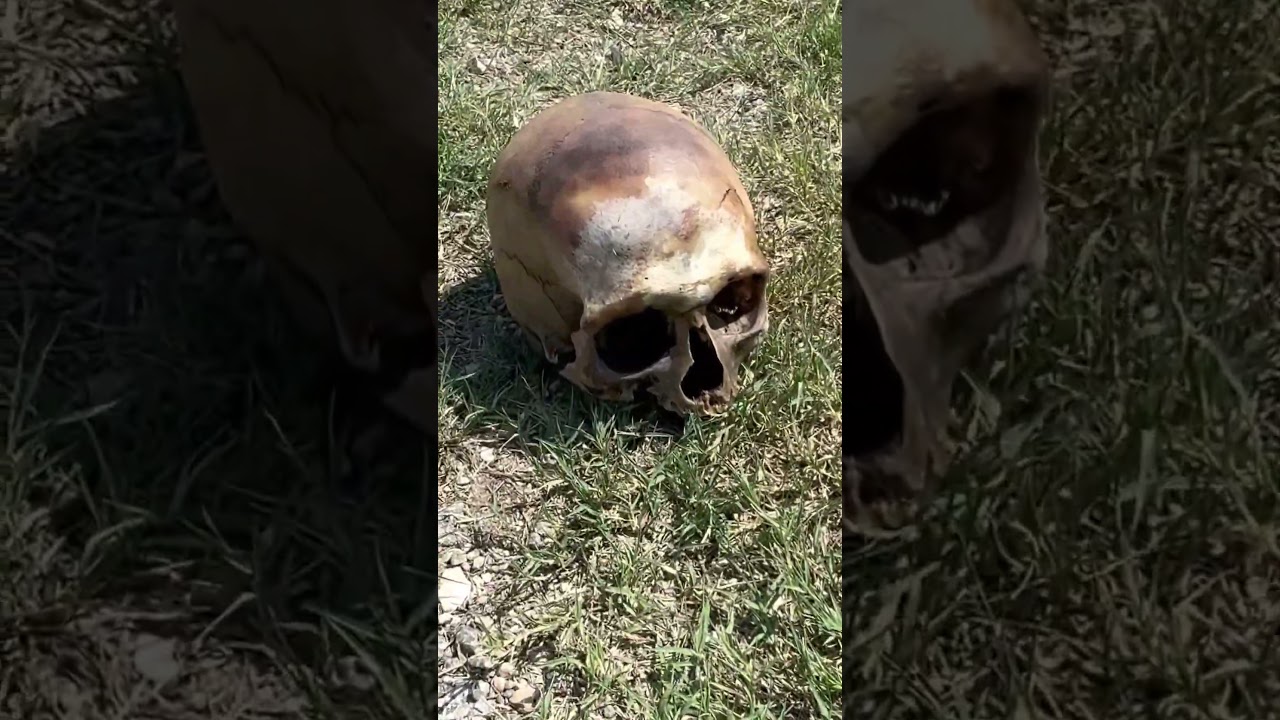 WALTER FOUND A HUMAN SKULL