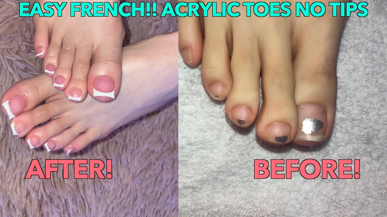 FRENCH TIP ACRYLIC TOES!| ACRYLIC TOES NO TIPS| FRENCH TIP HACK!