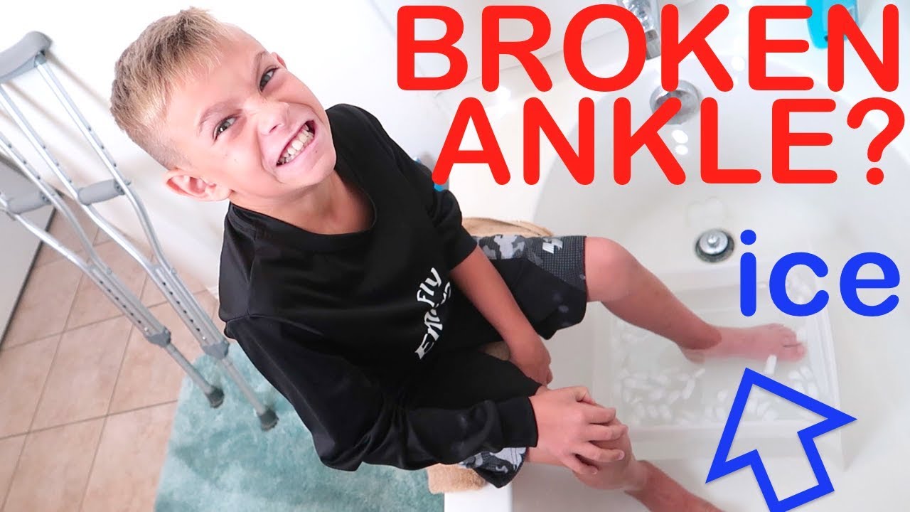 BROKEN ANKLE? Super Cold Ice Bath!