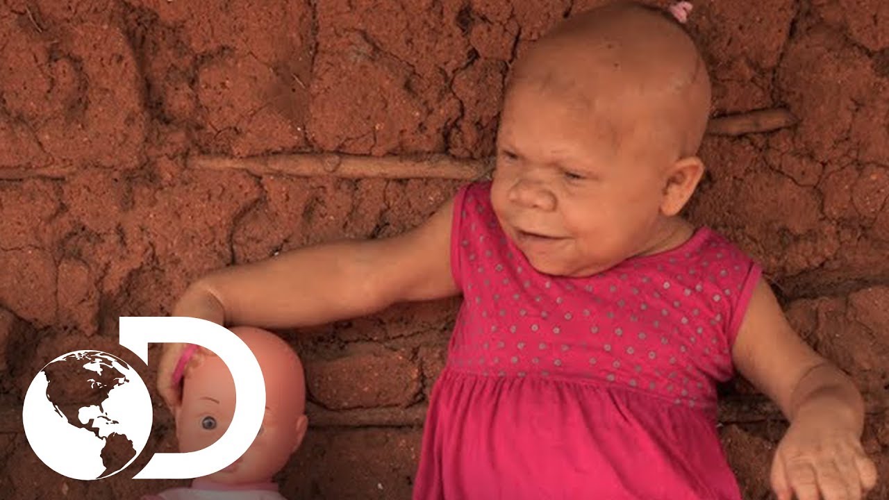 Mulher presa no corpo de uma crian&ccedil;a | Meu Corpo, Meu Desafio l Discovery Brasil