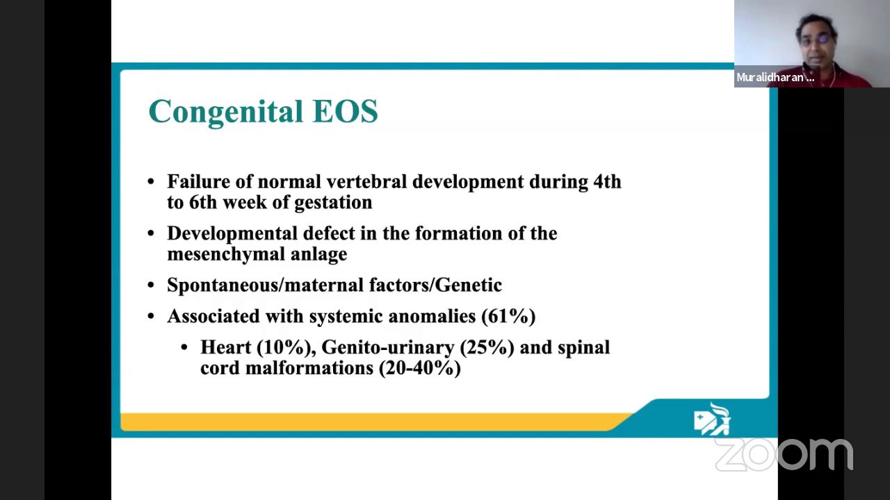 Early onset scoliosis