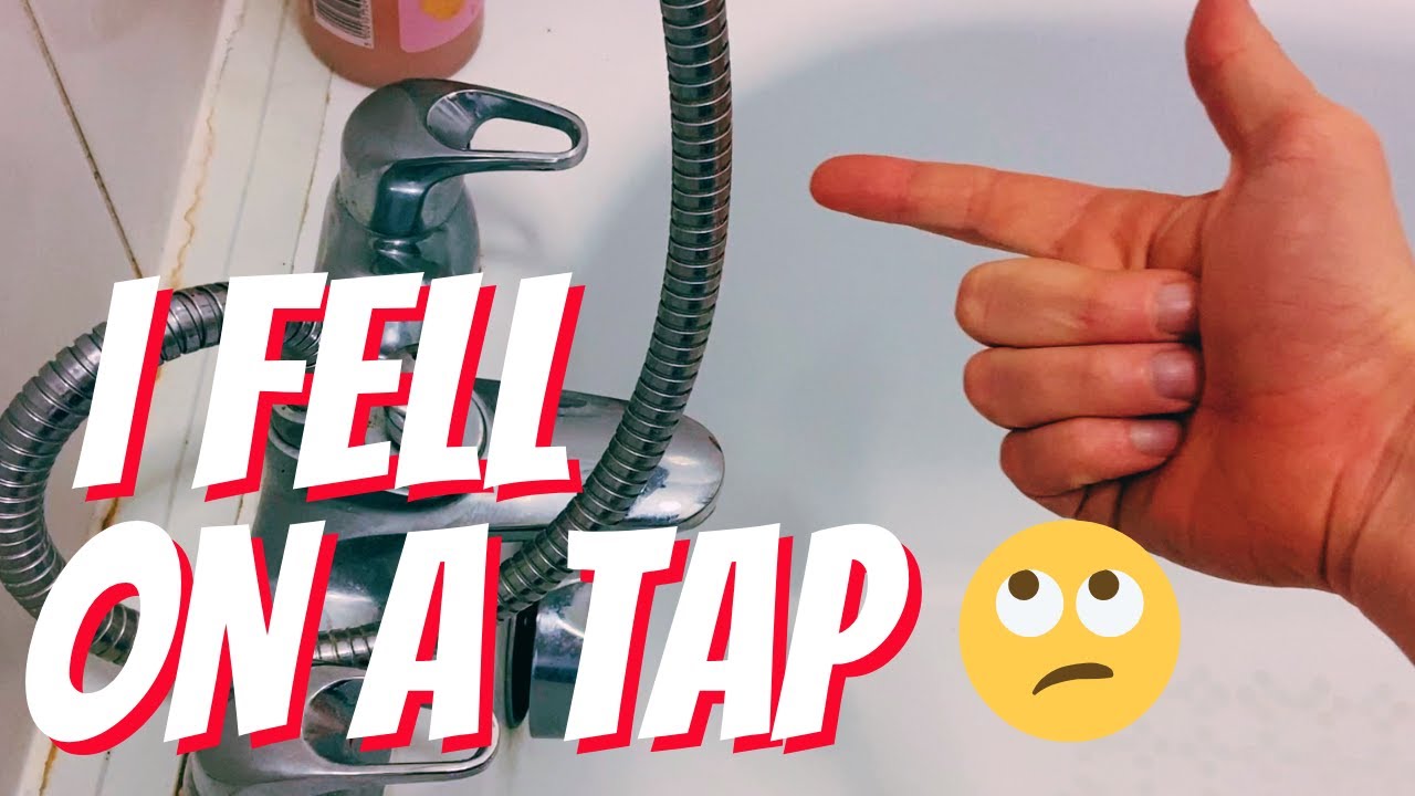 I FELL ON A TAP