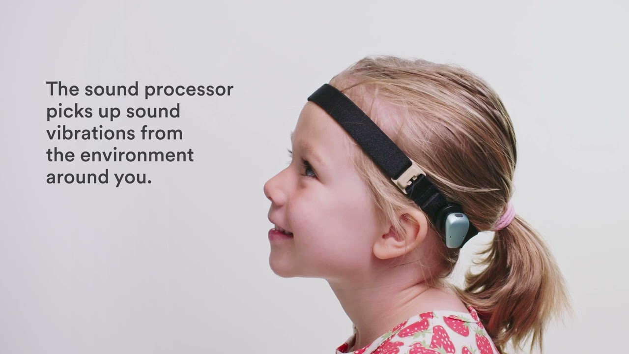 Cochlear&trade; Baha&reg; 6 Max Sound Processor. First of its kind.