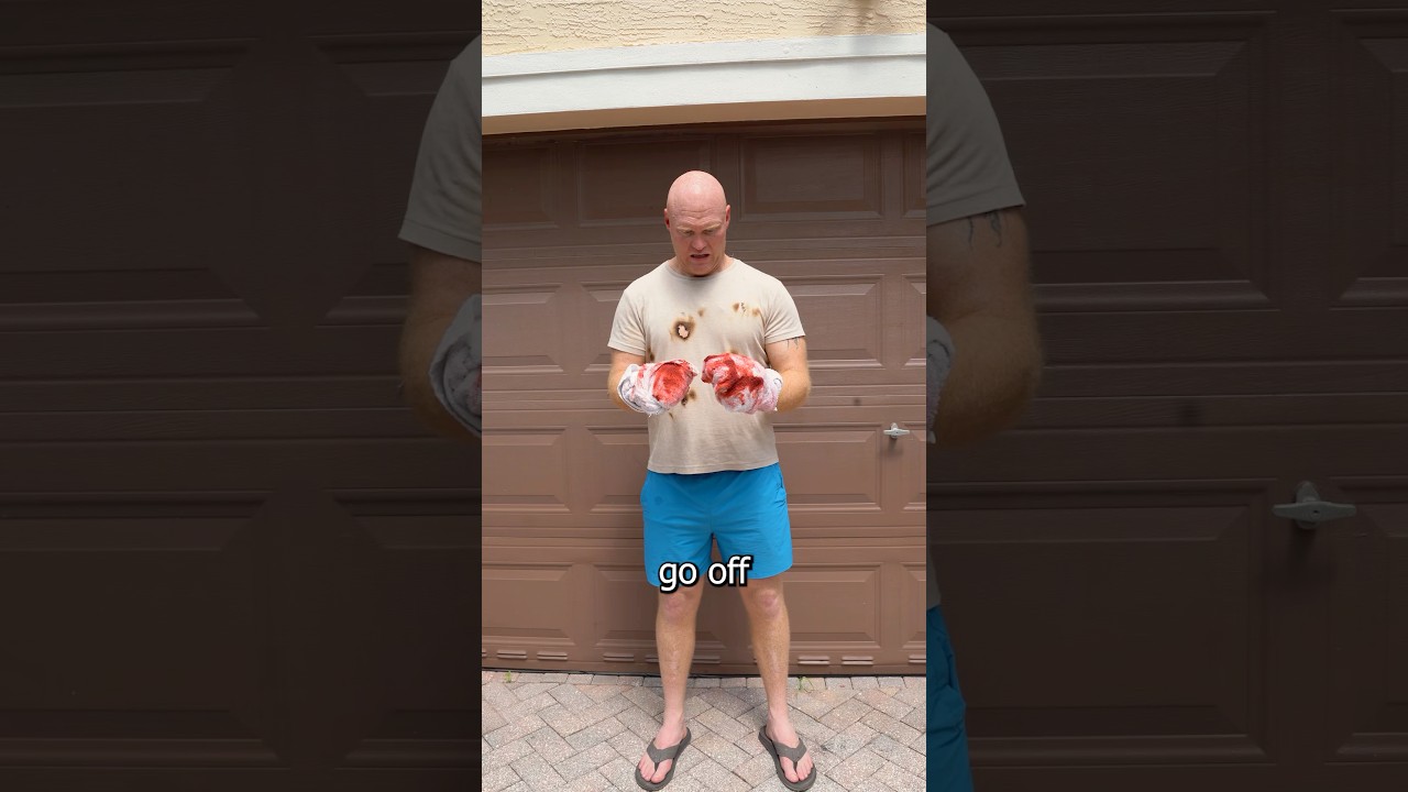 Real things I’ve seen as a Firefighter. It’s always the last firework. 