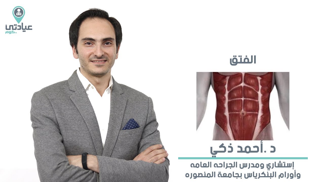 الفتق  مع  د . أحمد ذكي _ دكتور جراحة عامة بالمنصورة