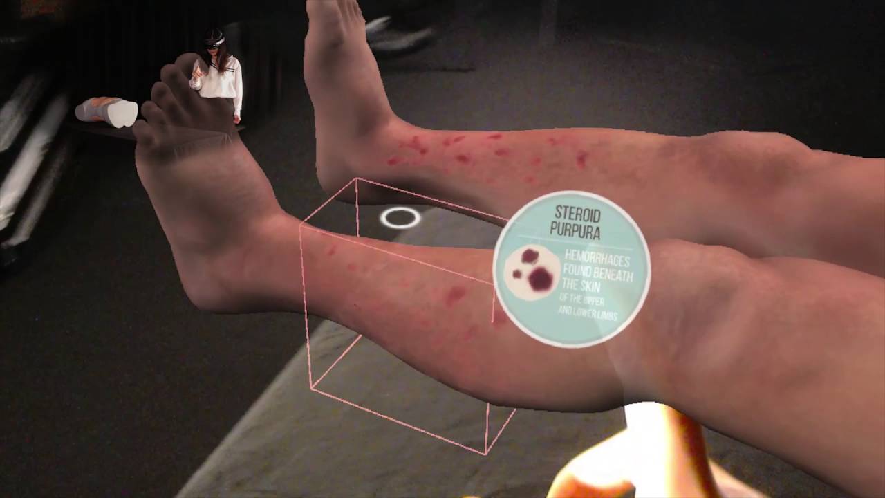 MediSIM demo (HoloLens with world's first abdominal simulator)