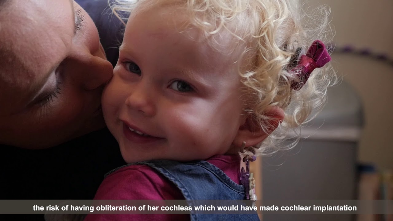 Baby Neave: youngest in Africa to receive cochlear implant