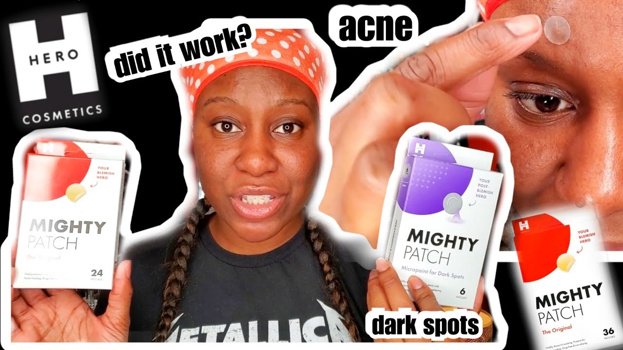 MIGHTY PATCH REVIEW ON DARK SKIN | HERO COSMETICS 2020