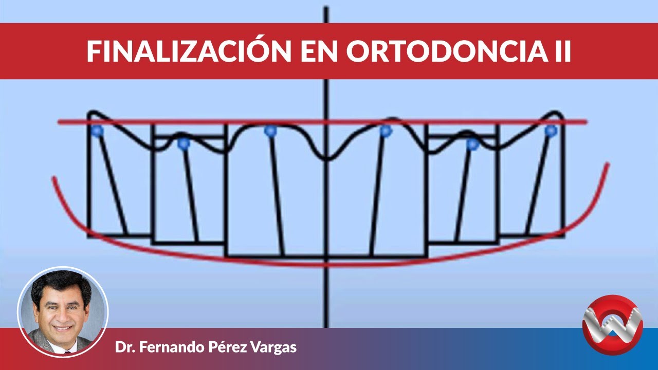 Finalizacion en ortodoncia II
