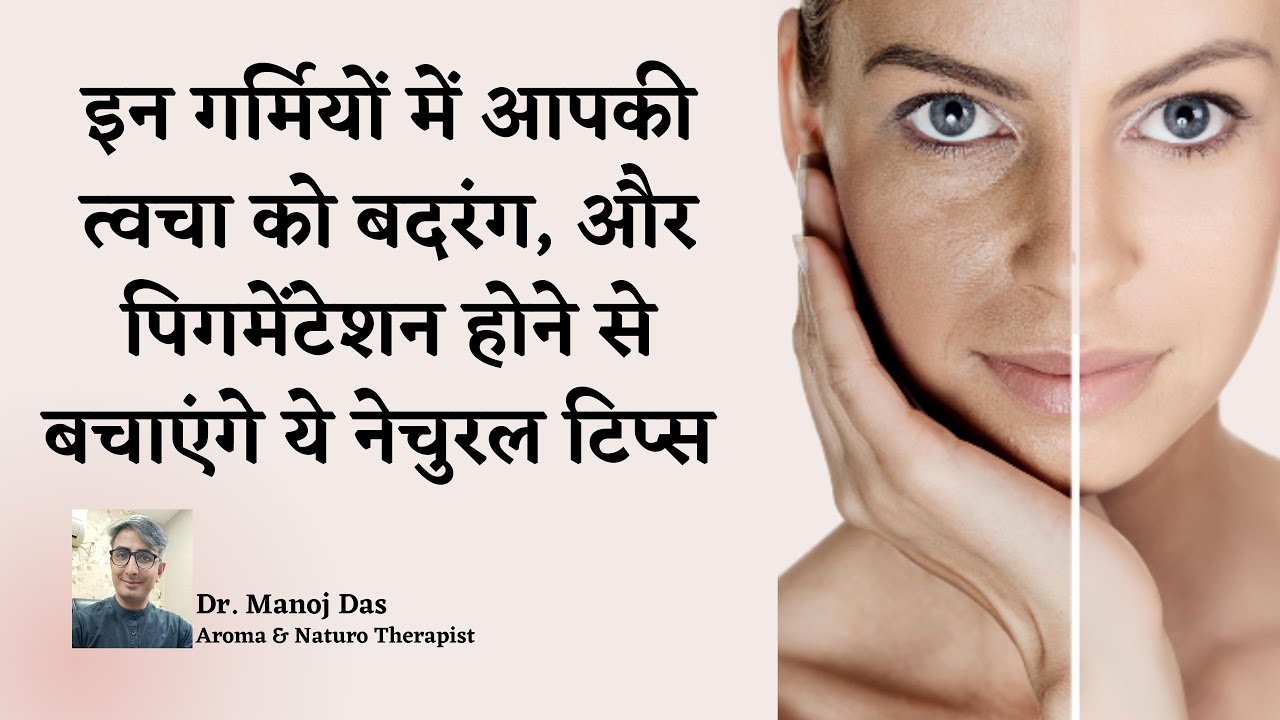 इन गर्मियों में आपकी त्वचा को बदरंग, और पिगमेंटेशन होने से बचाएंगे ये नेचुरल टिप्स I Dr. Manoj Das