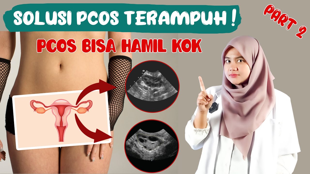 PENANGANAN PCOS DAN KOMPLIKASI PCOS