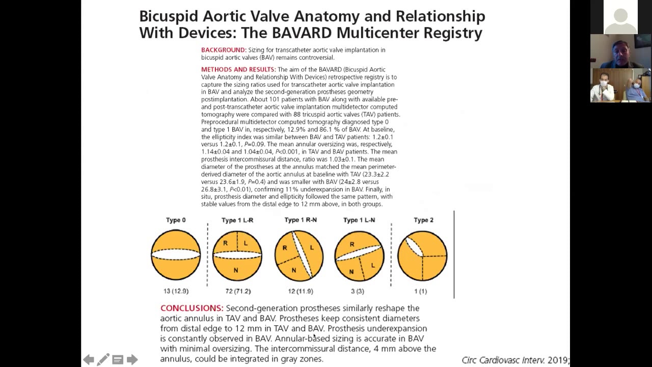 La TC cardiaca nella valutazioni della Stenosi aortica Bicuspide.