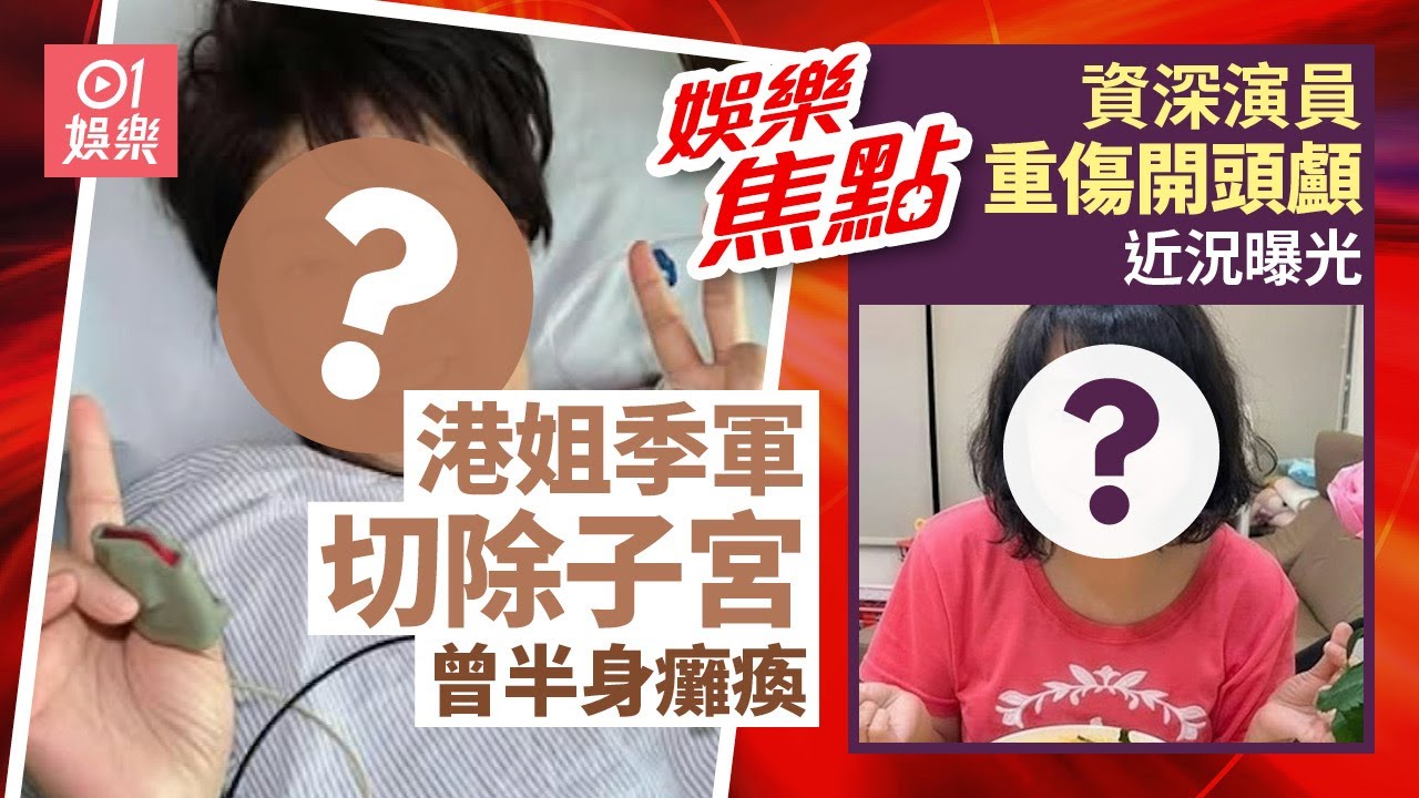 港姐季軍做子宮切除手術被好友調侃不能生育　曾患罕見病半邊身癱瘓｜資深演員跌倒重傷開顱取血塊昏迷5天　近況曝光｜1月25日娛樂新聞 #今日娛樂 #香港01