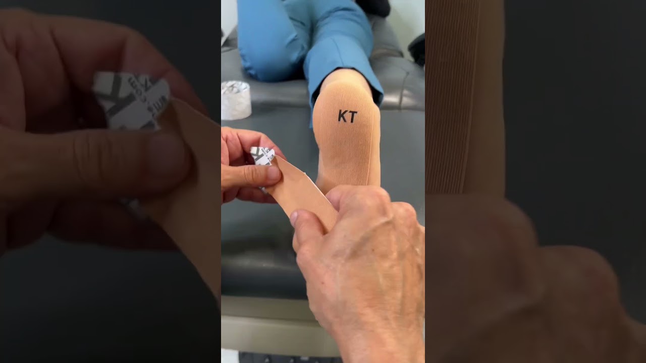 How Taping Helps Plantar Fasciitis