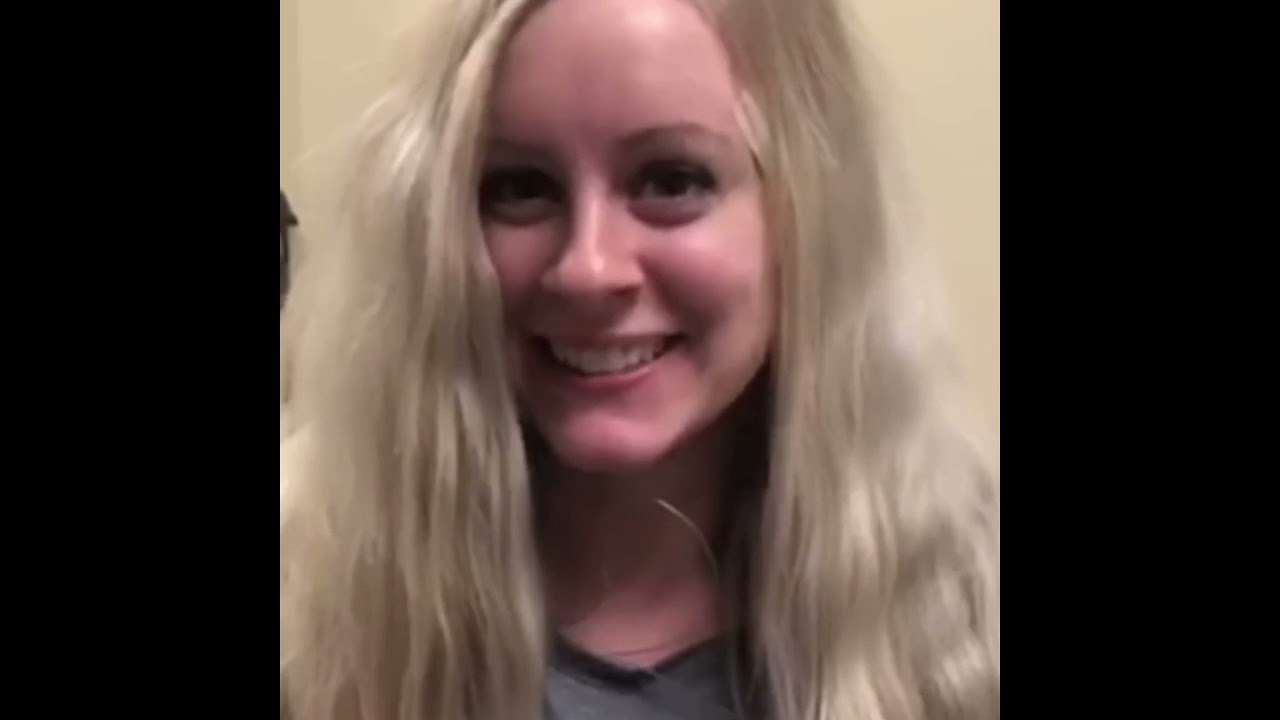 T21 Hemiplegic Migraines - Amazing Response To Reed Migraine Procedure