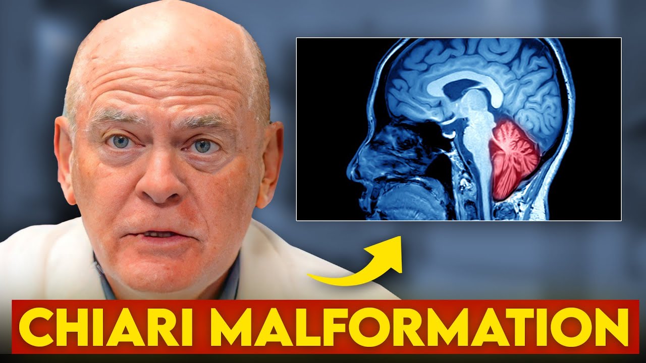 Chiari Malformation The DEADLY Condition That's Hiding in Plain Sight