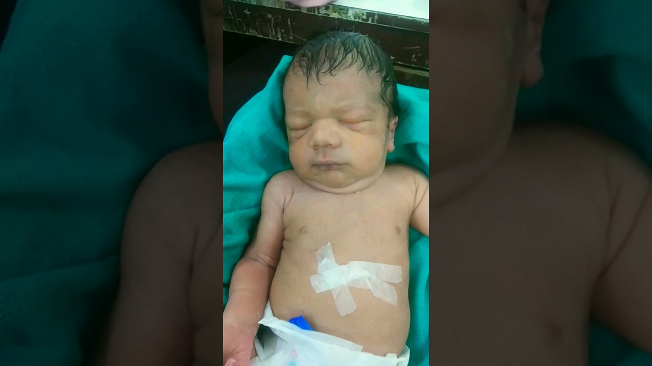 Icu Baby Care❤#cutebaby #icu #newbornbaby #emergency #baby #babycare #hospital #newborn #cute