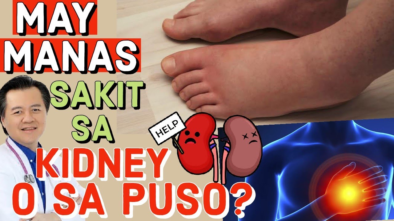 May Manas: Sakit Ba Sa Kidney O Sa Puso - Payo ni Doc Willie Ong