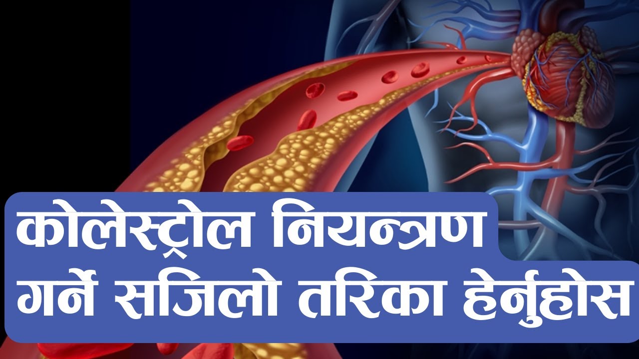 Cholesterol कोलेस्टेरोल नियन्त्रण गर्ने सजिलो तरिका यस्तो छ Nepali Health Tips
