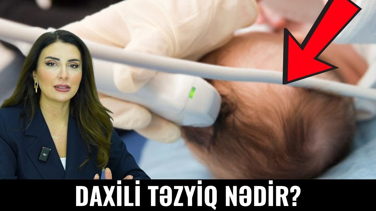 Uşaqlarda kəllə daxili təzyiq nədir?
