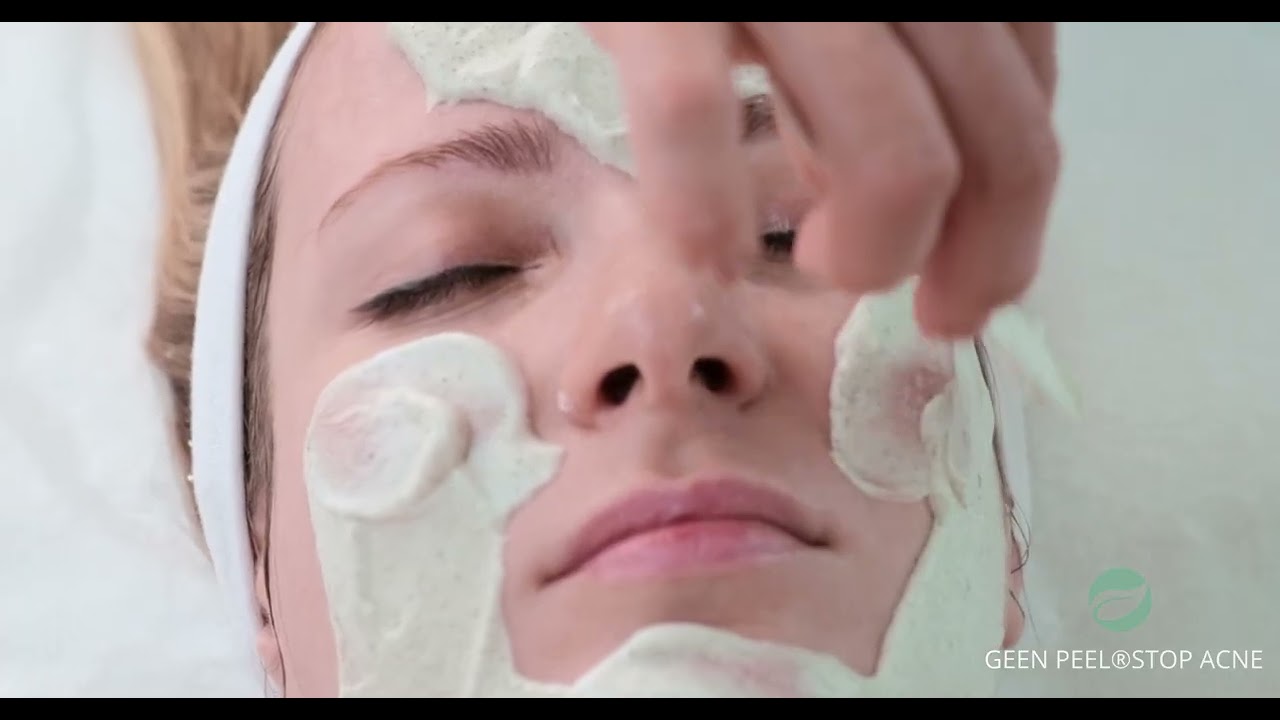 Stop Acne