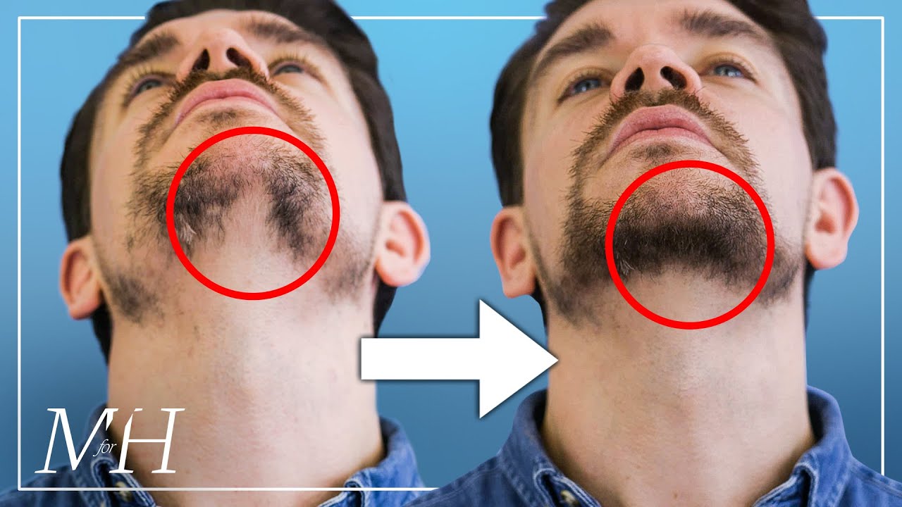 How To Fix Your Patchy Beard… Fast!