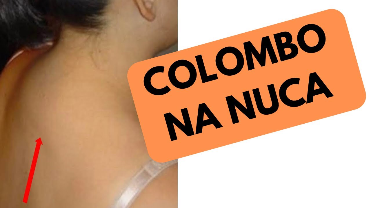 EXERCÍCIO PARA TIRAR O CALOMBO NA NUCA #cervical #postural #coluna