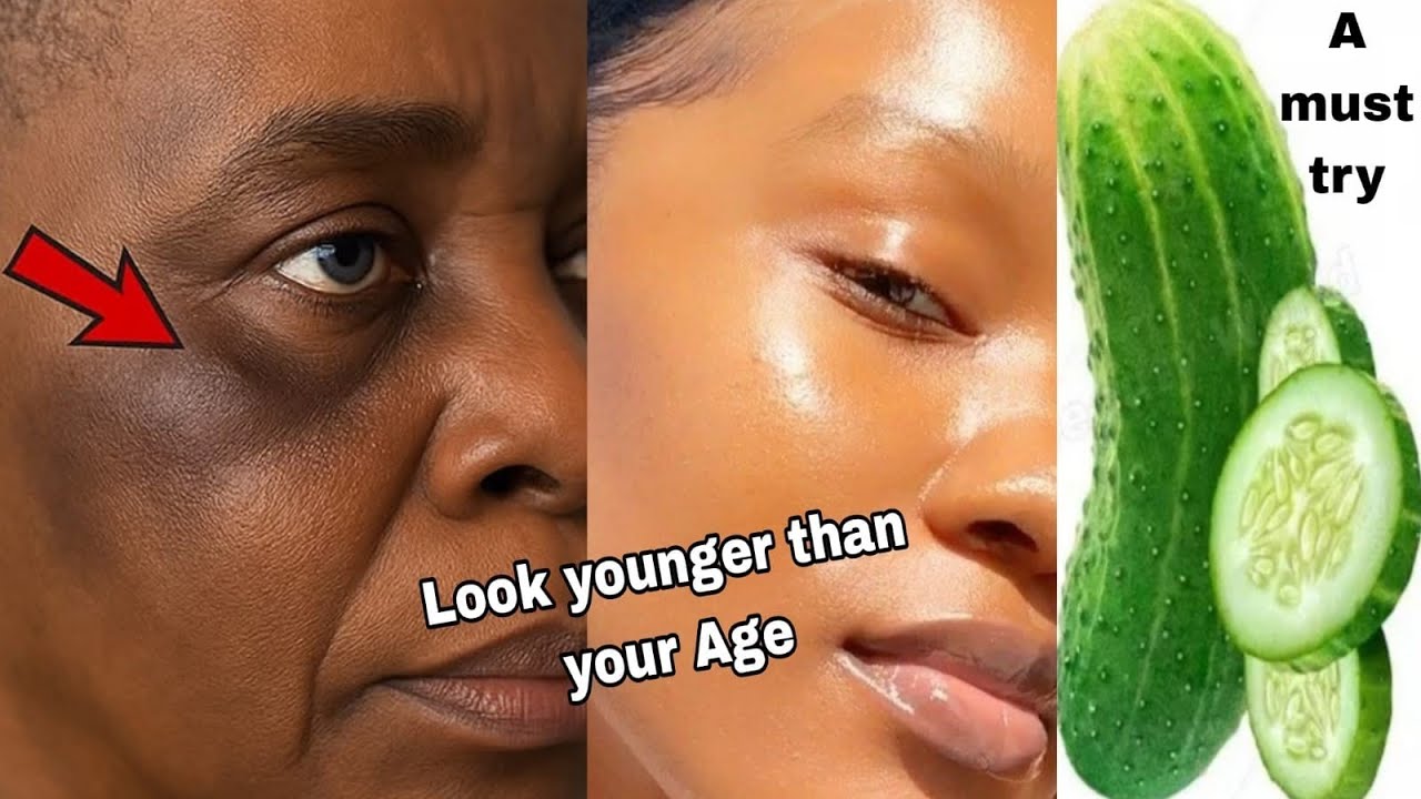 How I use cucumber 🥒remove Darkspots,Acne and hyperpigmentation wrinkles forever completely