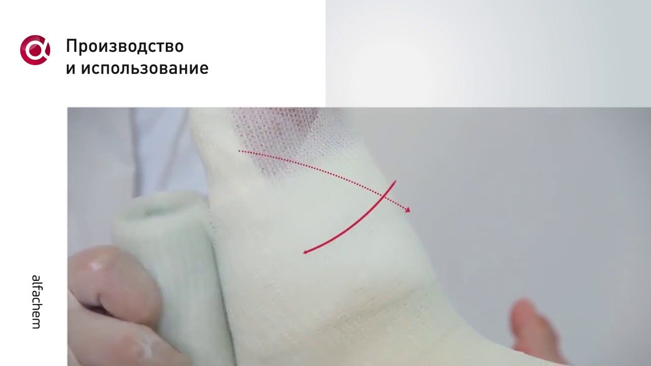 АльфаХим. Полимерные бинты Alfacast&reg;