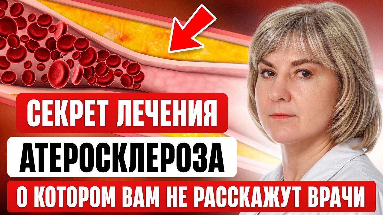 Как очистить сосуды от атеросклеротических бляшек и тромбов