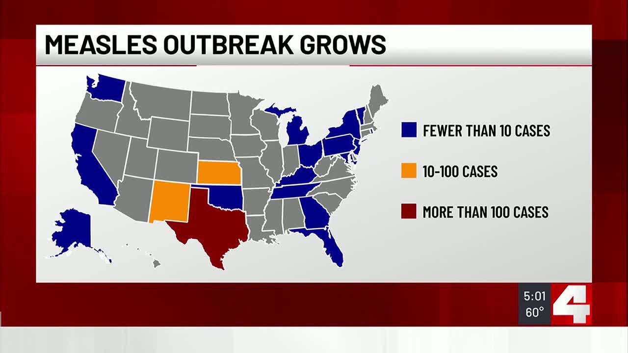 As White House orders infectious disease funding to stop, St. Louis cautions area can’t handle me...