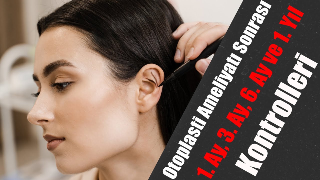 Otoplasti Sonrası Kontroller | 1. Ay, 3. Ay ve 1. Yıl Sonuçları!