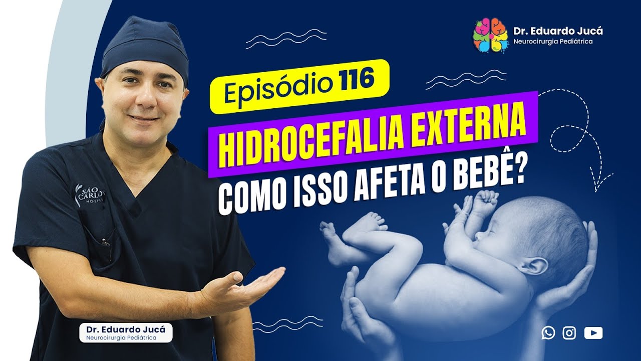 HIDROCEFALIA EXTERNA | EP.: 116