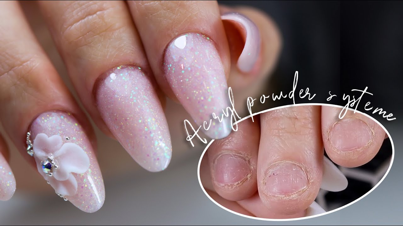 Acryl Système ´Résine ‘ sur Ongles Rongés !