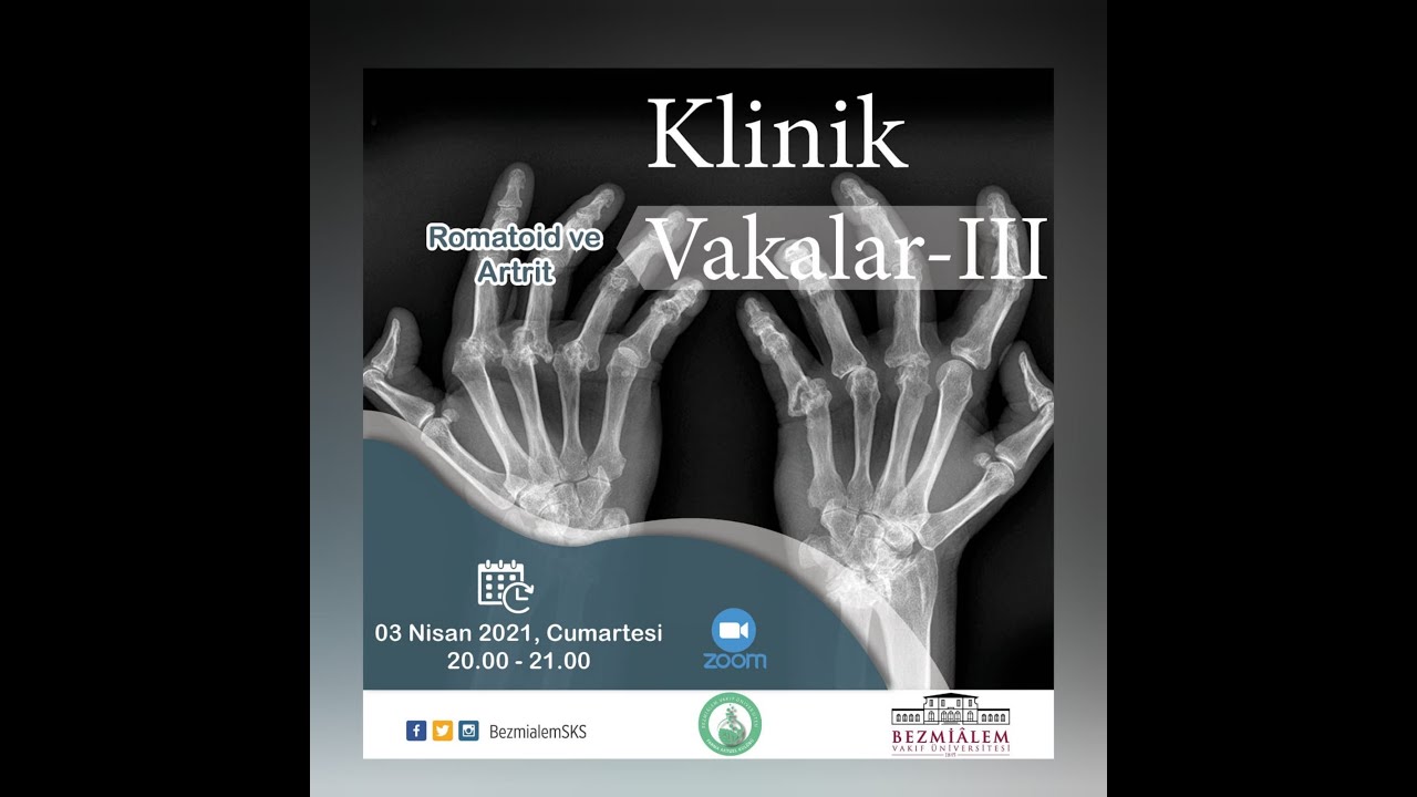 Klinik Vakalar III - Romatoid Artrit