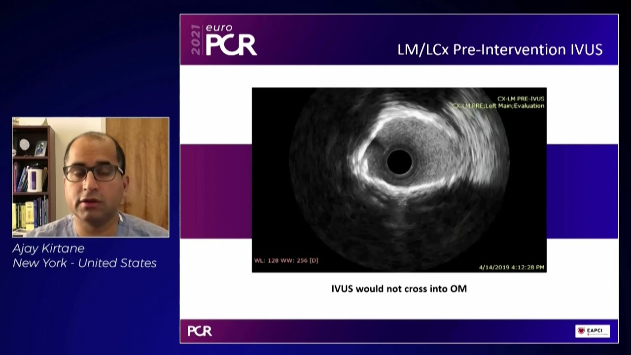 Latest insights: when to choose orbital atherectomy - EuroPCR 2021
