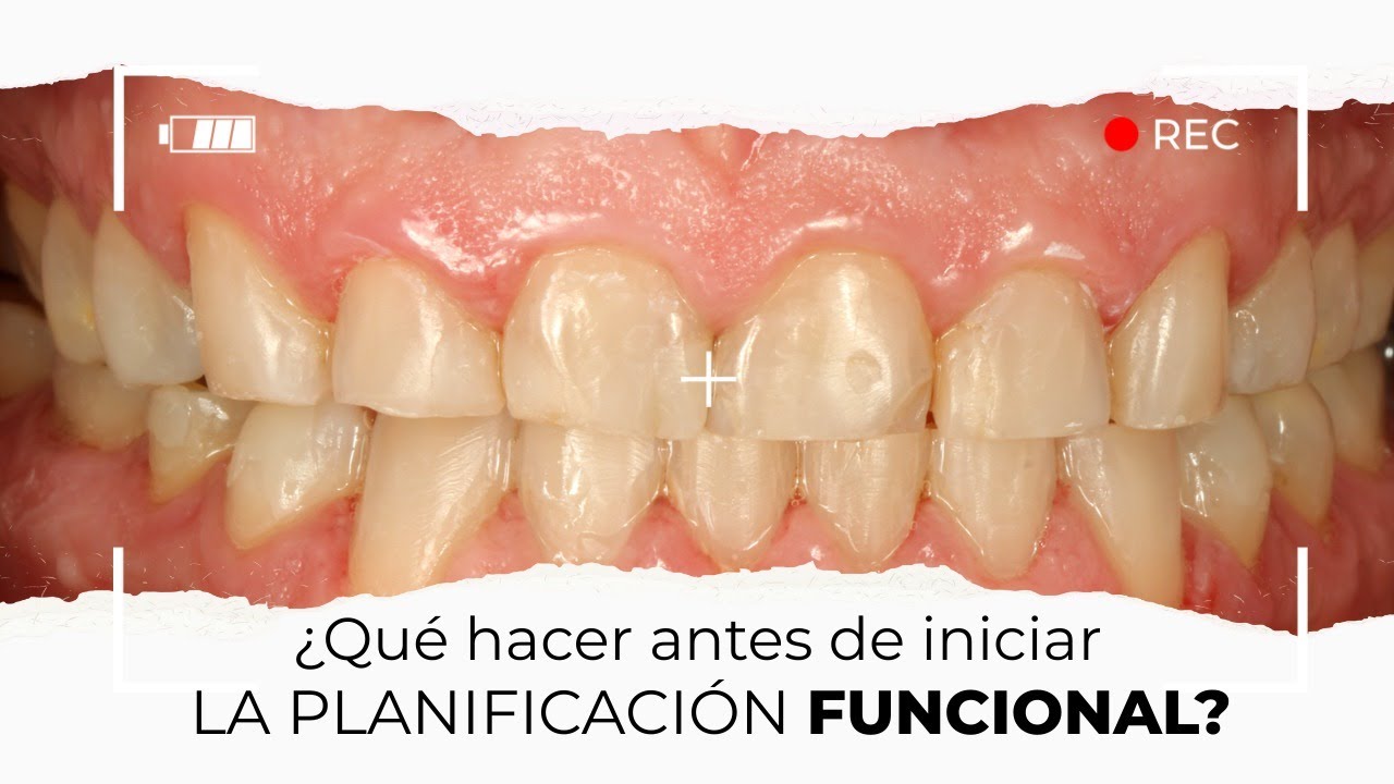 ¿Qué hacer antes de iniciar la planificación funcional? | Milko Villarroel con Armando Badet