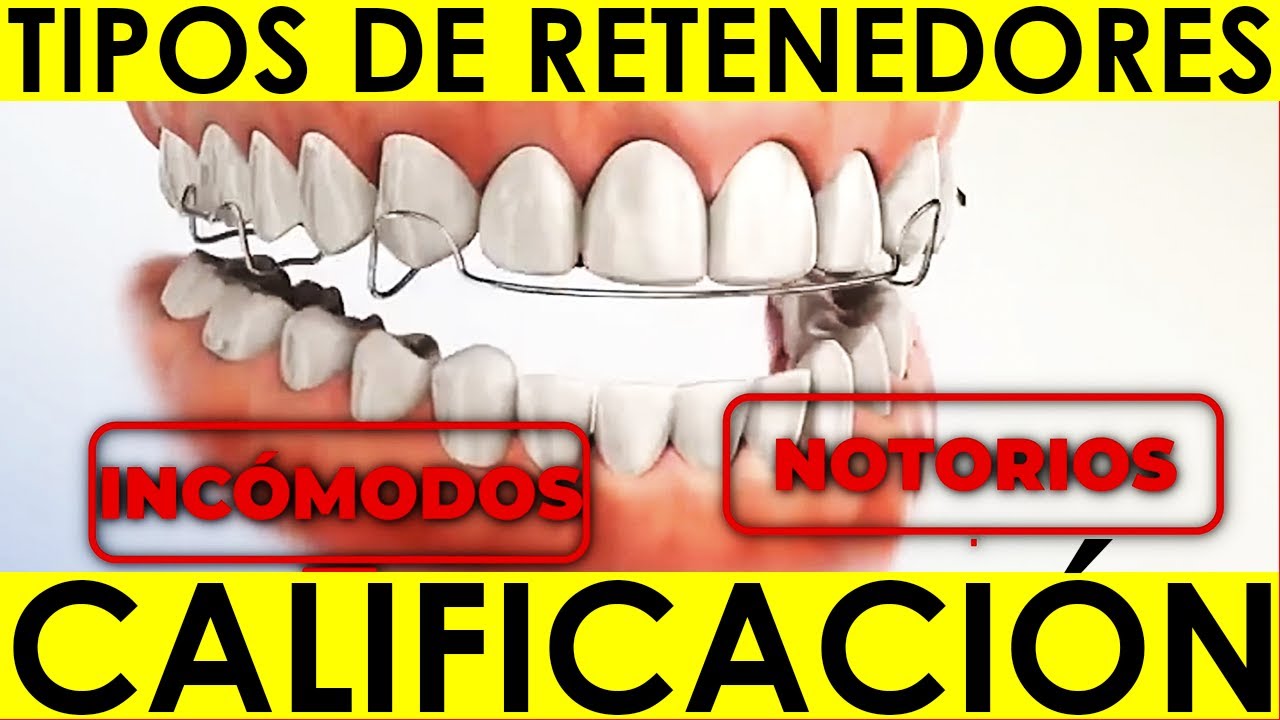 TIPOS DE RETENEDORES | Conoce las Ventajas, Desventajas y Diferencias de los M&Aacute;S RECOMENDADOS