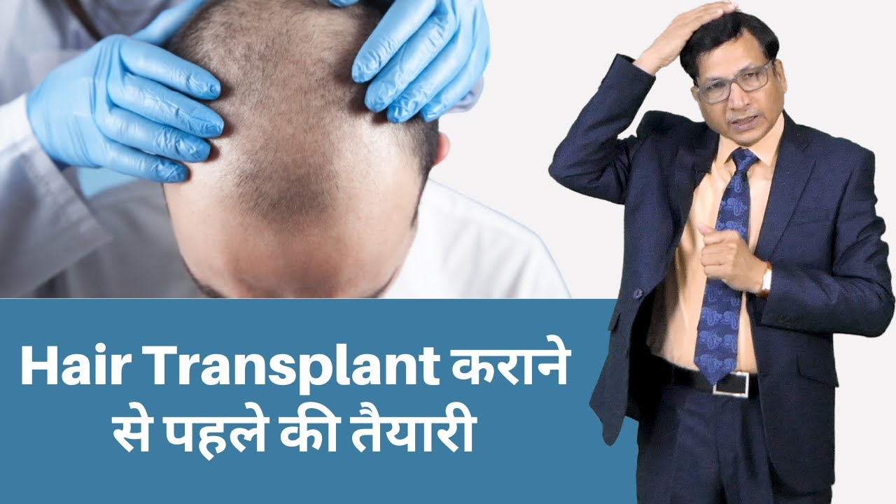 Hair Transplant कराने से पहले की तैयारी | Instructions Before Hair Transplant | Dr. Anil Garg