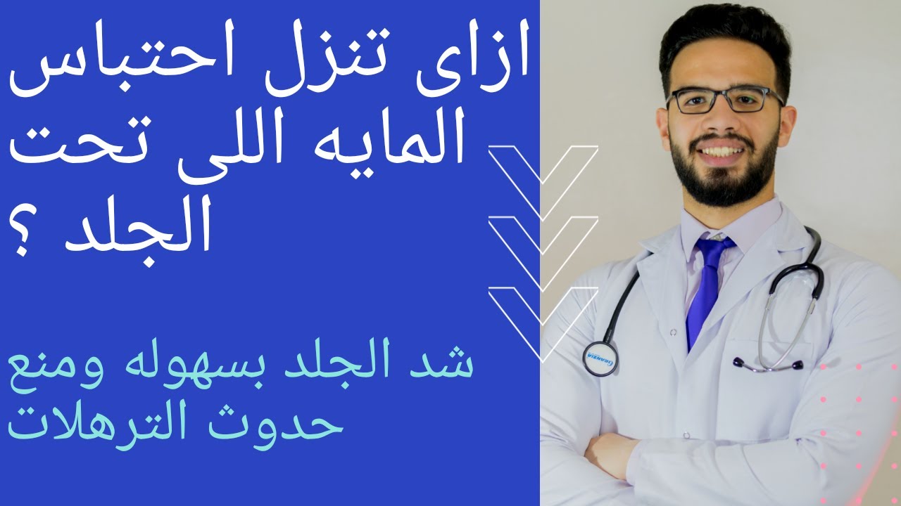 كيفيه التخلص من احتباس الماء تحت الجلد