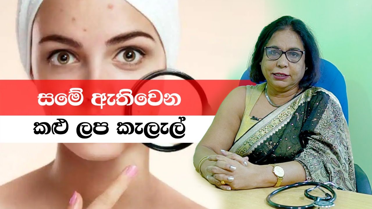 සමේ ඇතිවෙන කළු ලප කැලැල් මොනවාද?