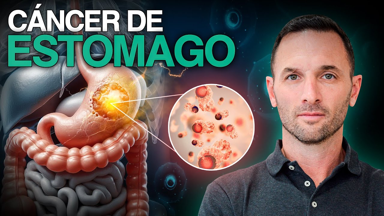 Los silenciosos síntomas del CÁNCER DE ESTOMAGO ¡Pon atención a cómo prevenirlo y su tratamiento!