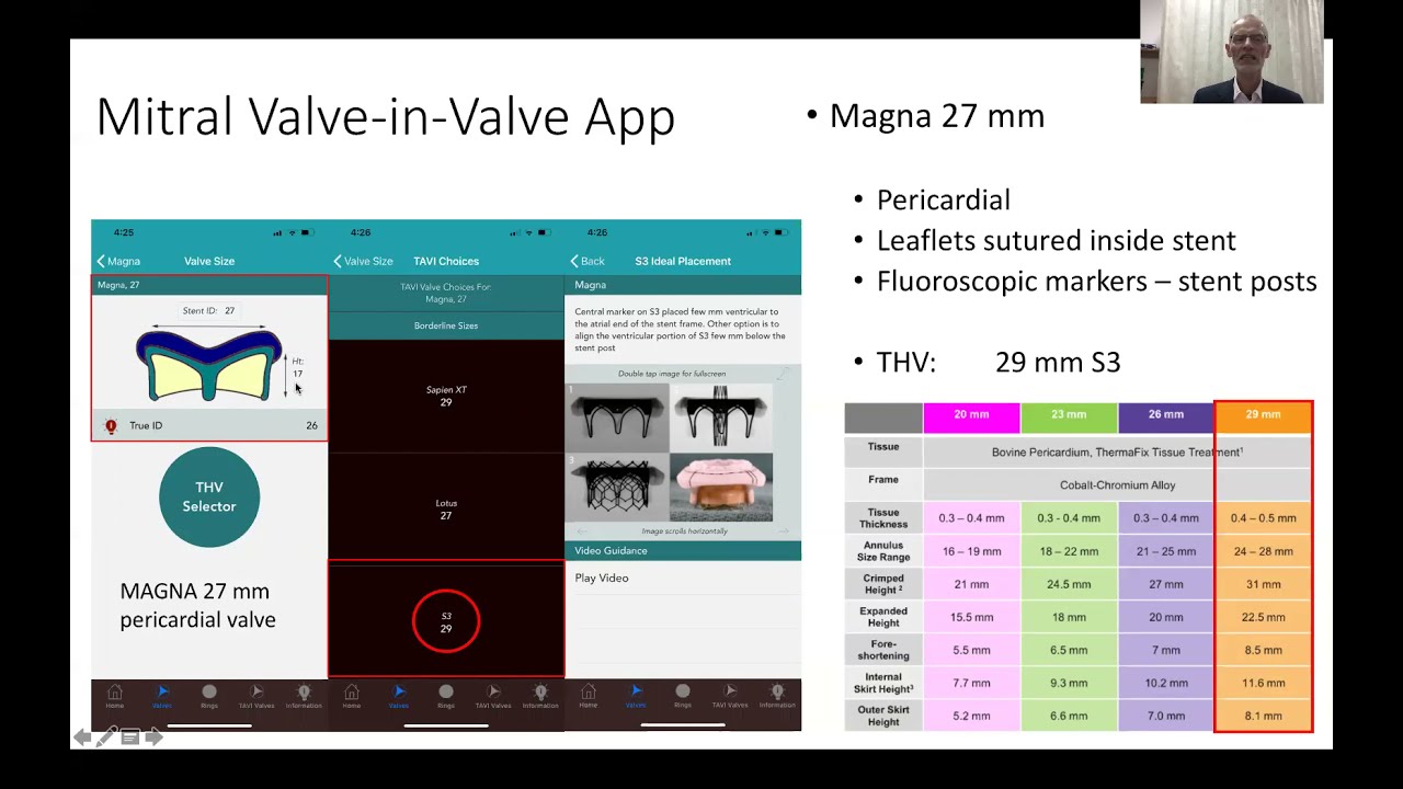 Dr Peter Hansen -  Mitral Valve in Valve in Valve webinar