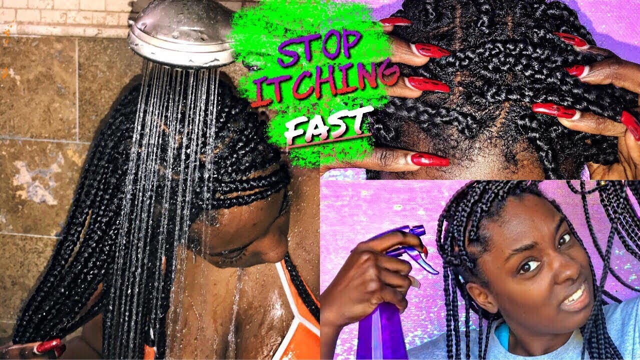 Box Braid Series: Stop itchy scalp FAST | alexuscrown