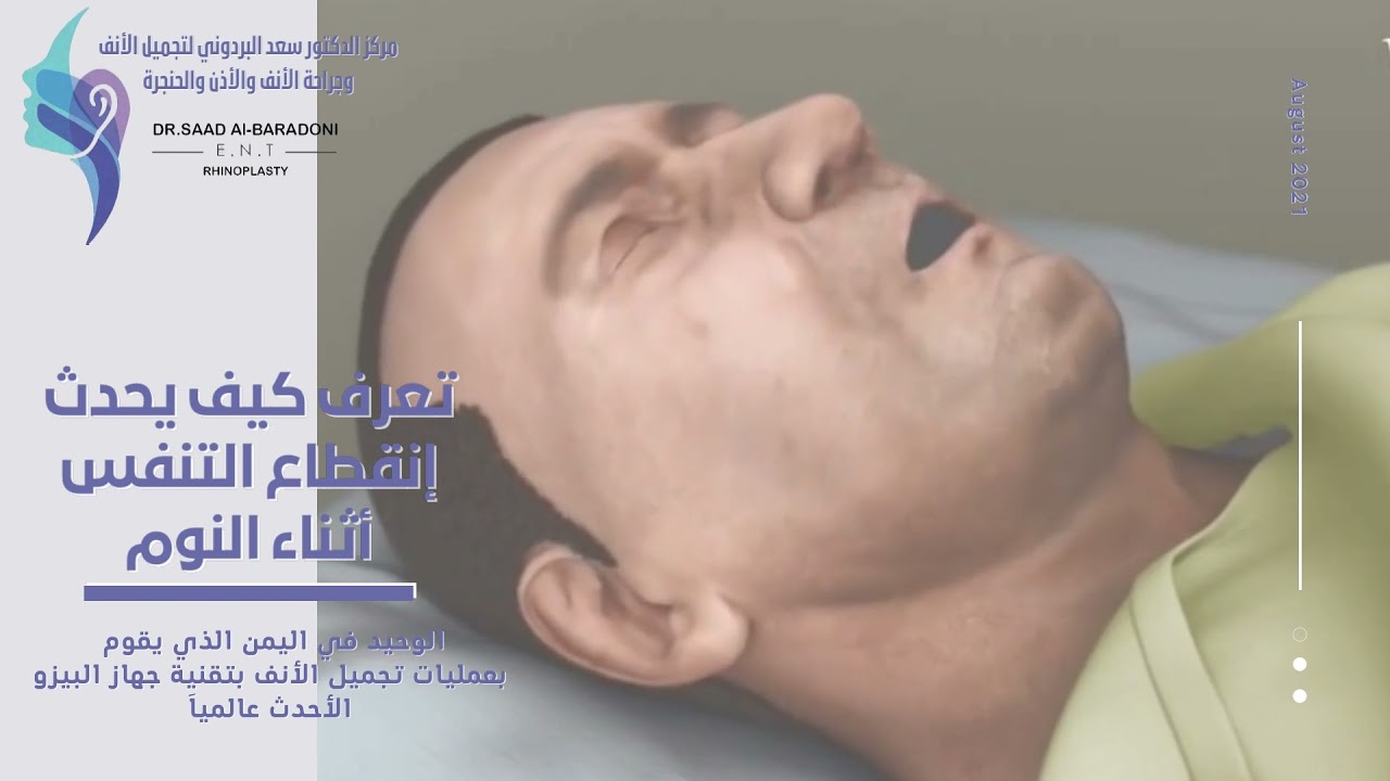تجميل الانف في اليمن ، صنعاء (انقطاع التنفس اثناء النوم) مركز الدكتور سعد البردوني لتجميل الانف