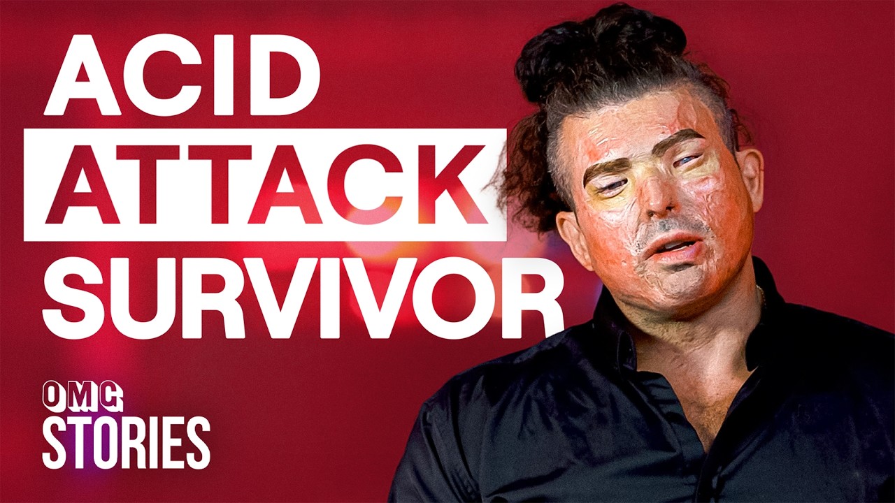 A Pint Of Acid To The Face Changed My Life Forever | OMG Stories