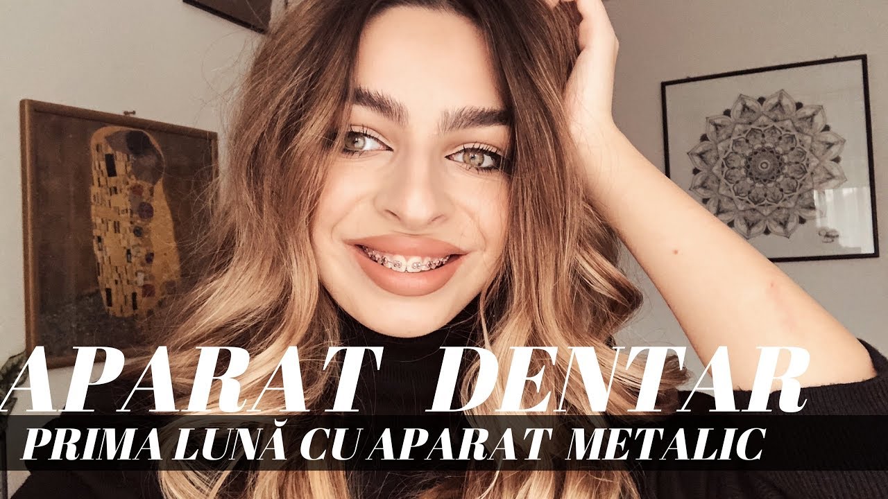 Prima lună cu APARAT DENTAR | Maria Dius