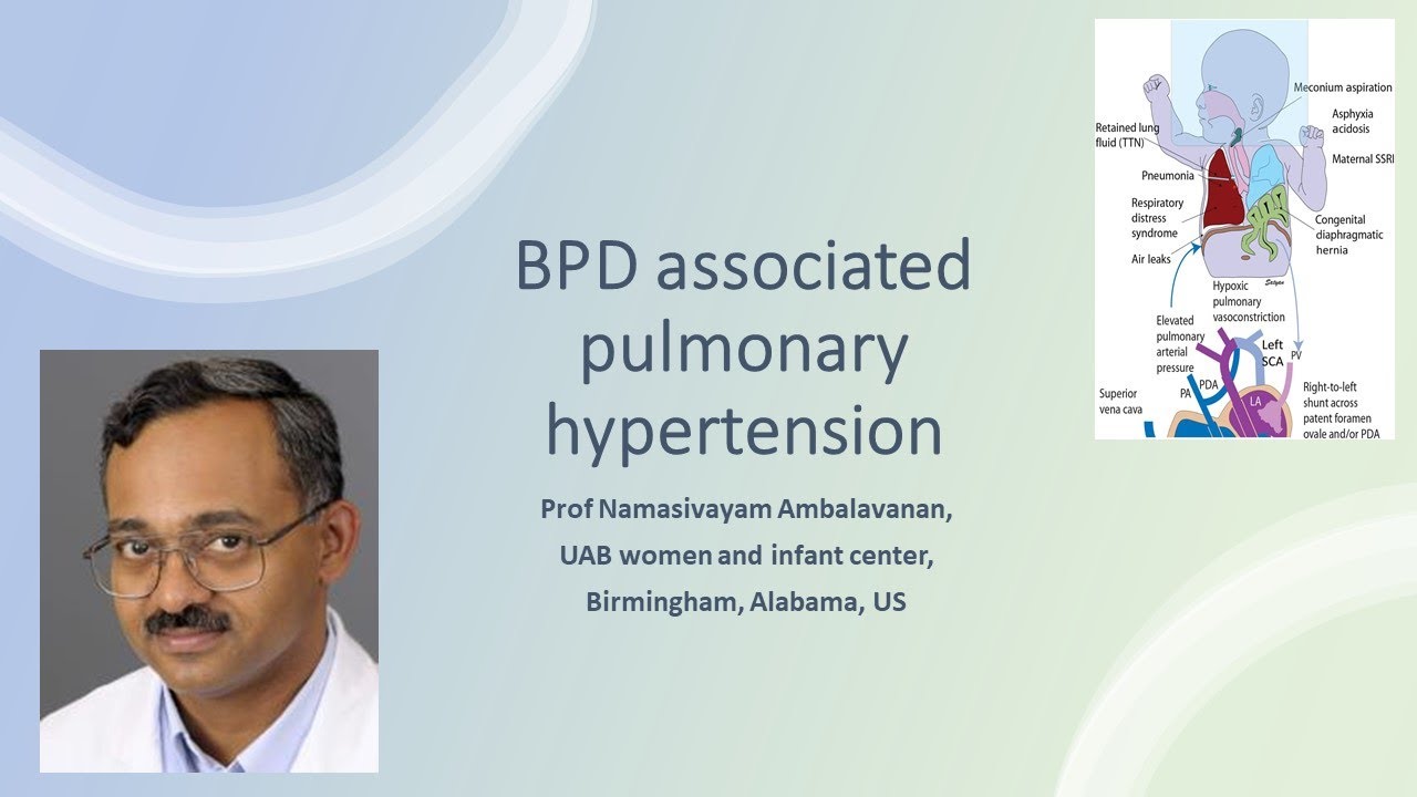 Bronchopulmonary dysplasia (BPD) associated pulmonary hypertension-Prof Ambalavanan