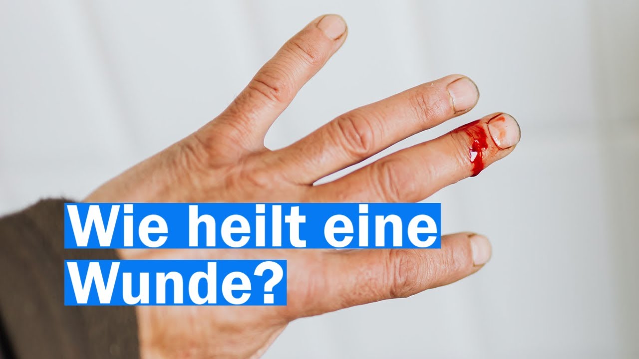 Wie funktioniert die Wundheilung?